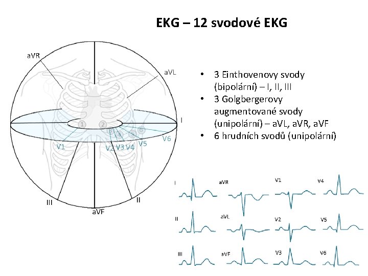 EKG – 12 svodové EKG • 3 Einthovenovy svody (bipolární) – I, III •