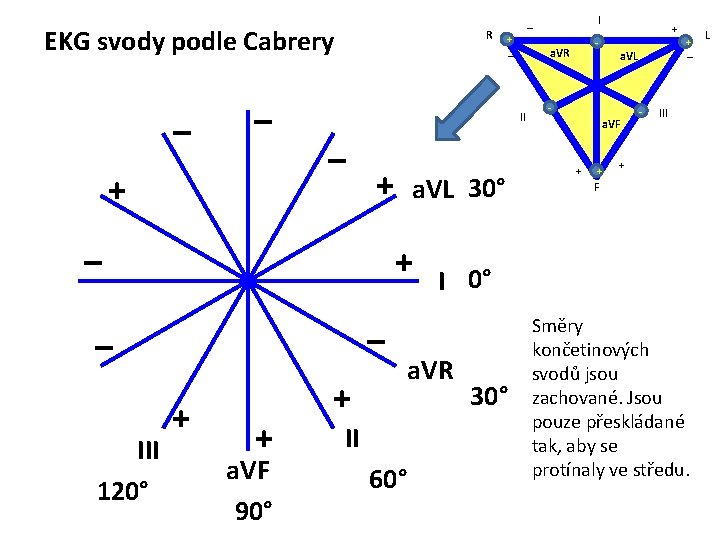 EKG svody podle Cabrery – – + R – + a. VL 30° +