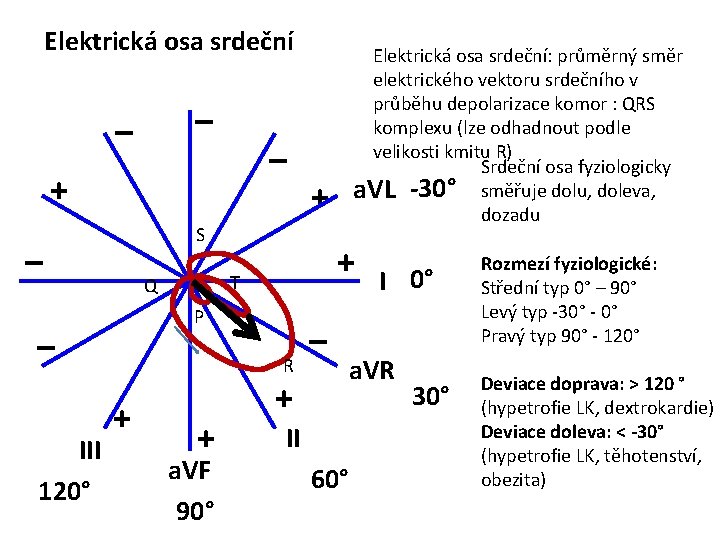 Elektrická osa srdeční – – – + + T Q P – III 120°