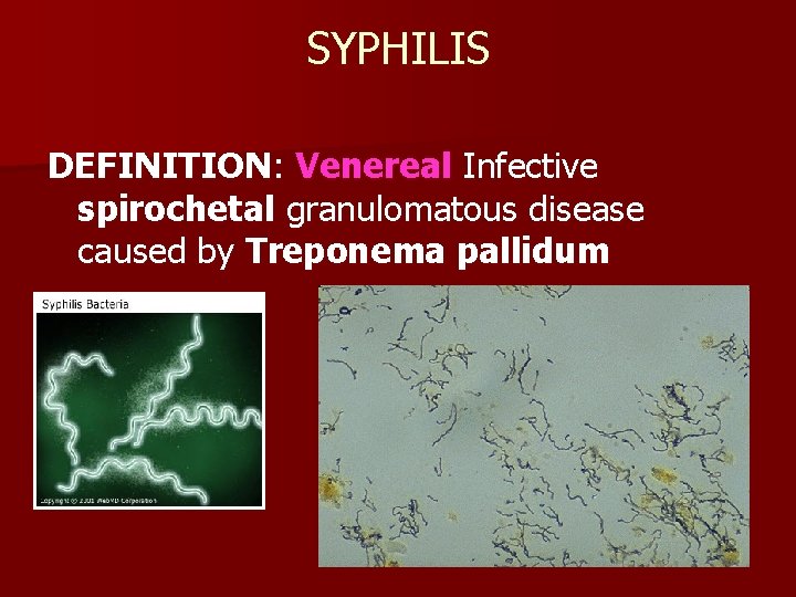 SYPHILIS DEFINITION: Venereal Infective spirochetal granulomatous disease caused by Treponema pallidum 