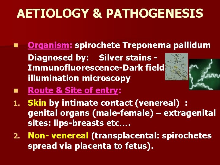 AETIOLOGY & PATHOGENESIS Organism: spirochete Treponema pallidum Diagnosed by: Silver stains Immunofluorescence-Dark field illumination