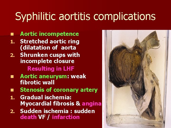 Syphilitic aortitis complications n 1. 2. n n 1. 2. Aortic incompetence Stretched aortic