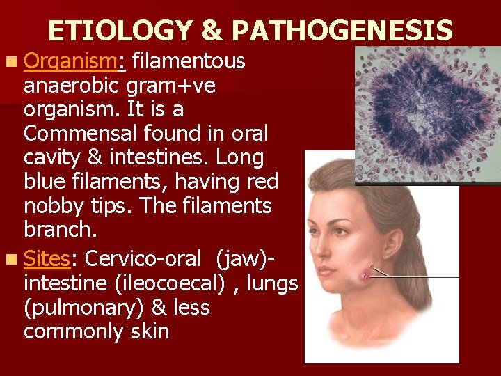ETIOLOGY & PATHOGENESIS n Organism: filamentous anaerobic gram+ve organism. It is a Commensal found