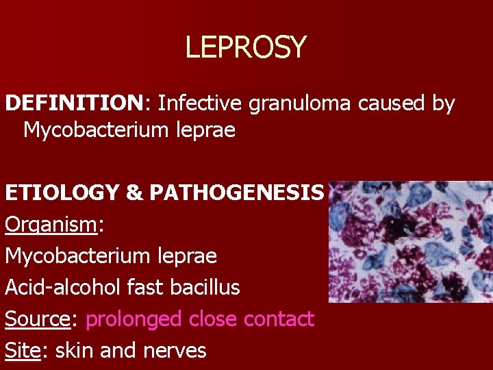 LEPROSY DEFINITION: Infective granuloma caused by Mycobacterium leprae ETIOLOGY & PATHOGENESIS Organism: Mycobacterium leprae