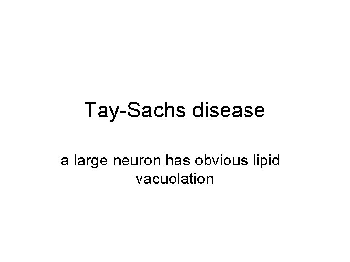 Tay-Sachs disease a large neuron has obvious lipid vacuolation 