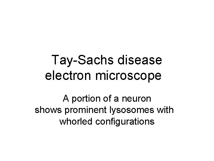 Tay-Sachs disease electron microscope A portion of a neuron shows prominent lysosomes with whorled