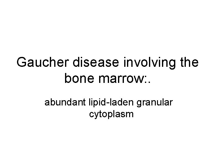 Gaucher disease involving the bone marrow: . abundant lipid-laden granular cytoplasm 