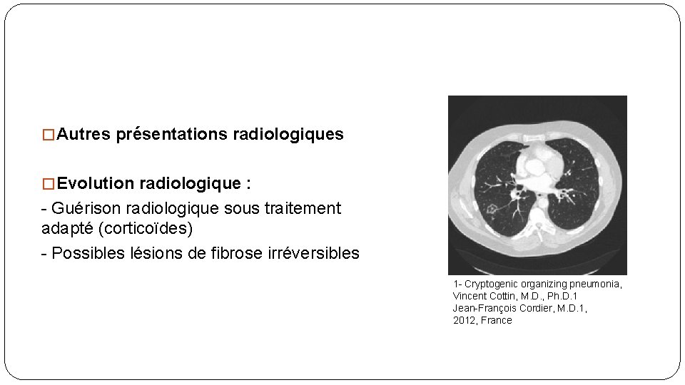 � Autres présentations radiologiques � Evolution radiologique : - Guérison radiologique sous traitement adapté