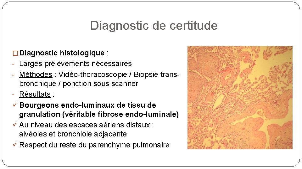 Diagnostic de certitude � Diagnostic histologique : - Larges prélèvements nécessaires - Méthodes :