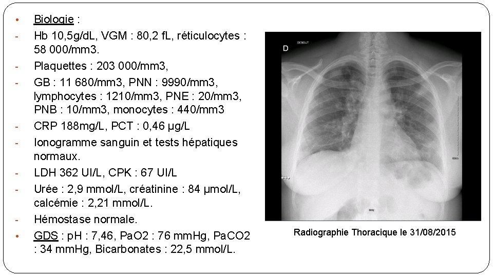  • - • Biologie : Hb 10, 5 g/d. L, VGM : 80,