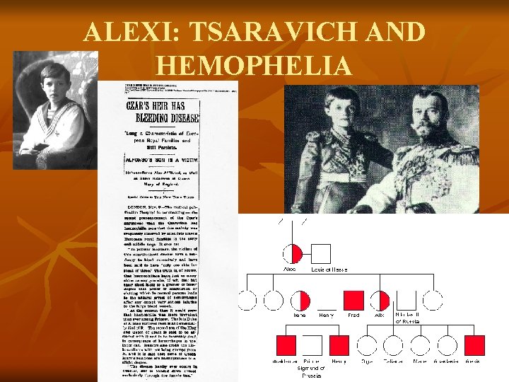 ALEXI: TSARAVICH AND HEMOPHELIA 