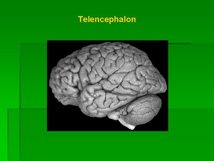Telencephalon 