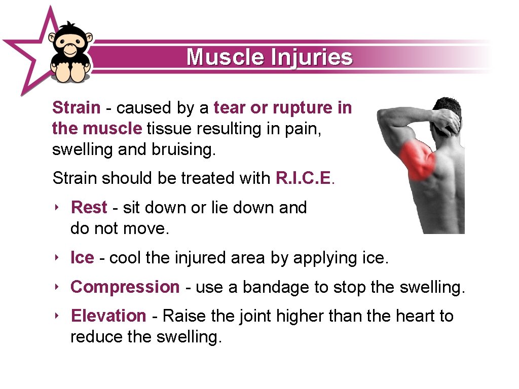 Muscle Injuries Strain - caused by a tear or rupture in the muscle tissue