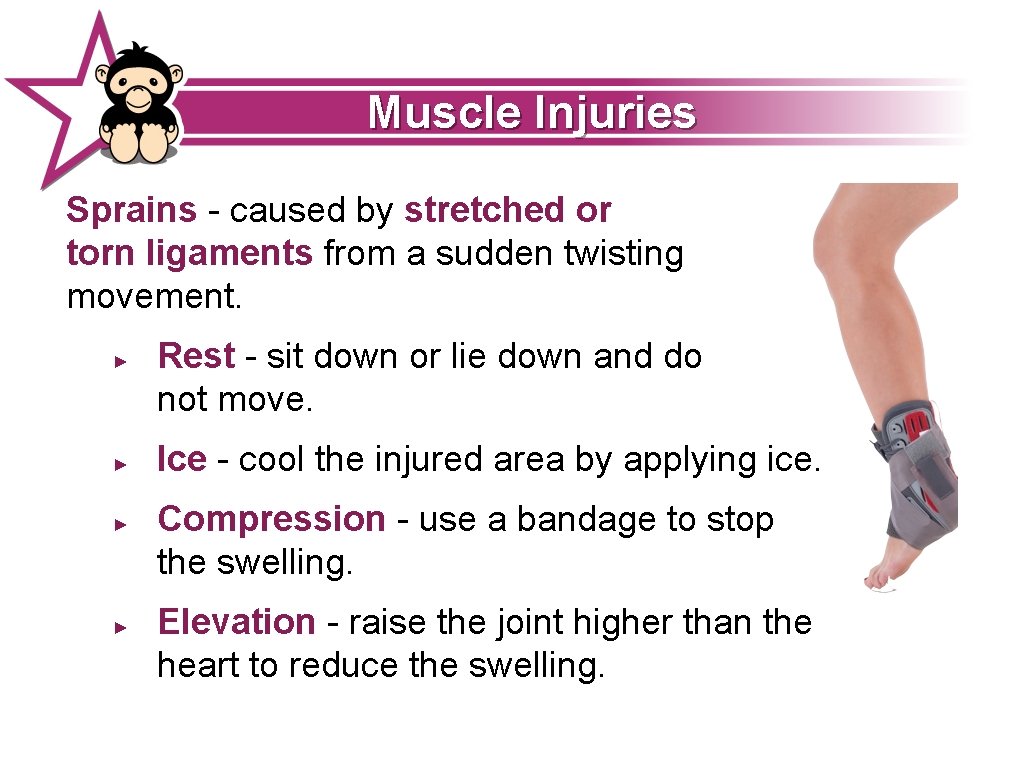 Muscle Injuries Sprains - caused by stretched or torn ligaments from a sudden twisting