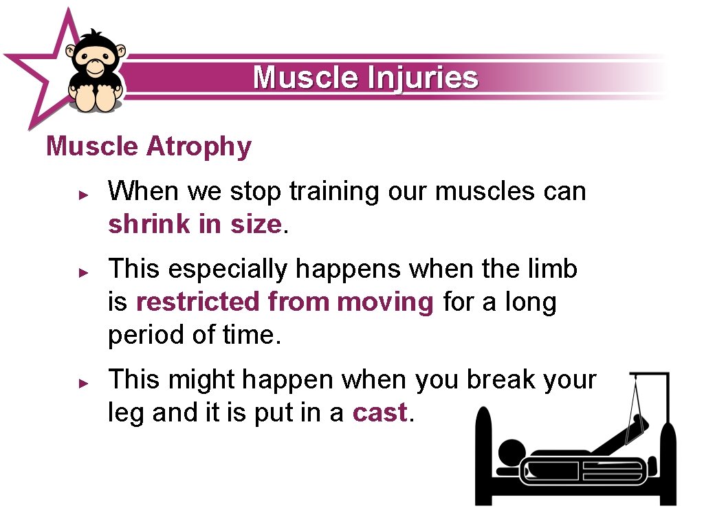 Muscle Injuries Muscle Atrophy ► ► ► When we stop training our muscles can