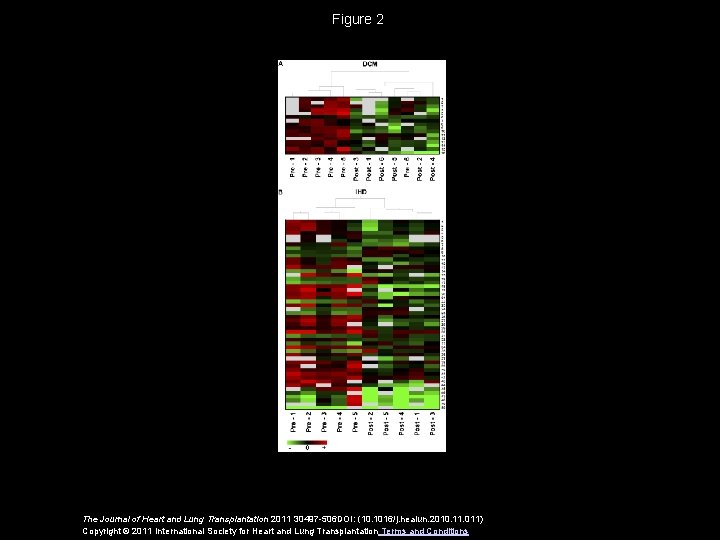 Figure 2 The Journal of Heart and Lung Transplantation 2011 30497 -506 DOI: (10.