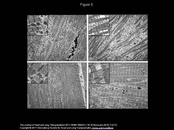 Figure 5 The Journal of Heart and Lung Transplantation 2011 30497 -506 DOI: (10.