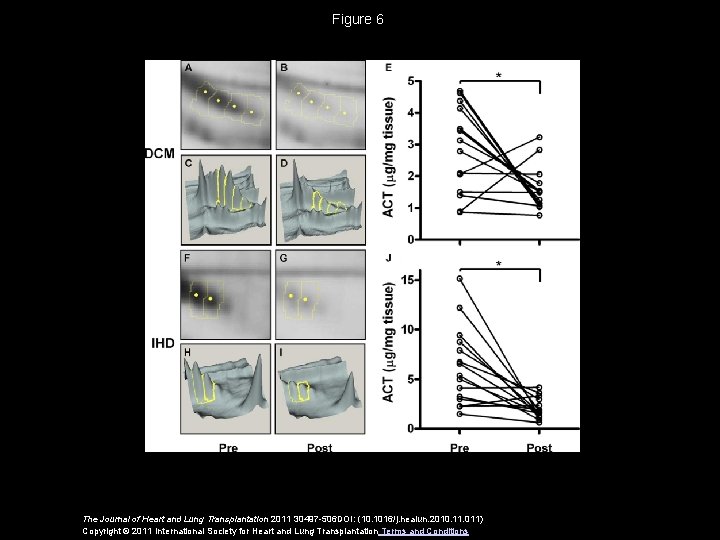 Figure 6 The Journal of Heart and Lung Transplantation 2011 30497 -506 DOI: (10.