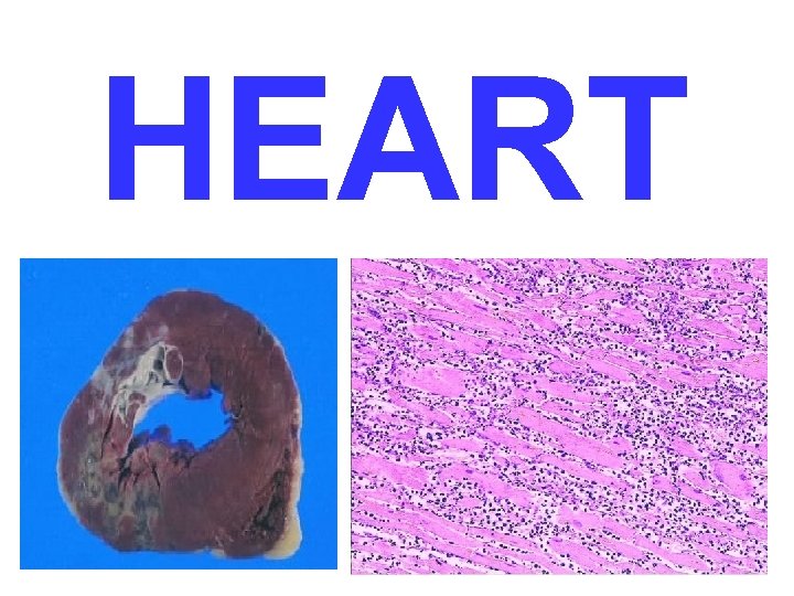 HEART 
