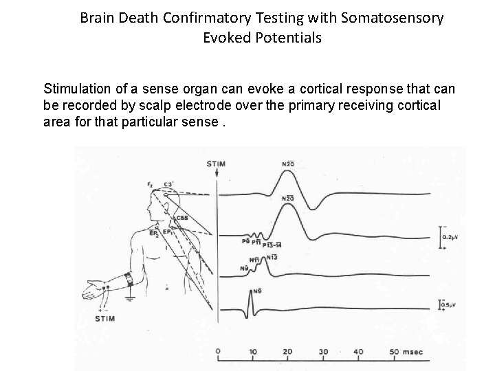 Brain Death Confirmatory Testing with Somatosensory Evoked Potentials Stimulation of a sense organ can Brain Death Confirmatory Testing with Somatosensory Evoked Potentials Stimulation of a sense organ can