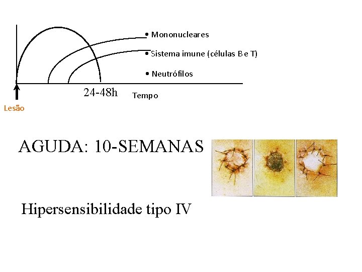 • Mononucleares • Sistema imune (células B e T) • Neutrófilos 24 -48 • Mononucleares • Sistema imune (células B e T) • Neutrófilos 24 -48