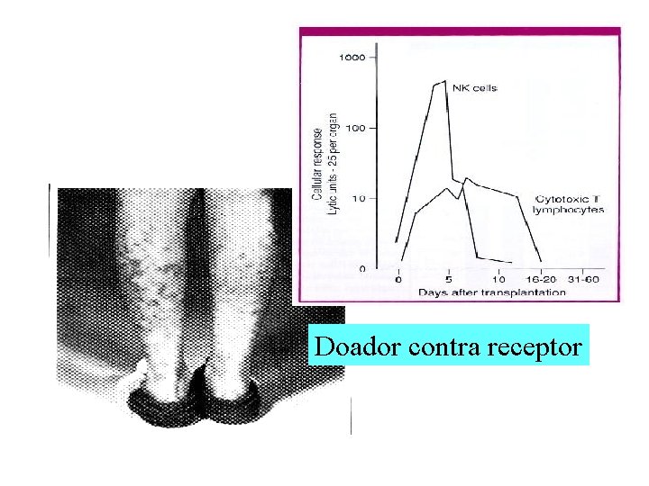 Doador contra receptor Doador contra receptor