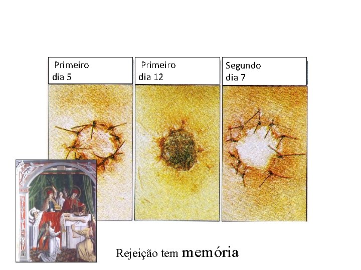 Primeiro dia 5 Primeiro dia 12 Segundo dia 7 Rejeição tem memória Primeiro dia 5 Primeiro dia 12 Segundo dia 7 Rejeição tem memória