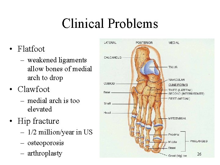 Clinical Problems • Flatfoot – weakened ligaments allow bones of medial arch to drop