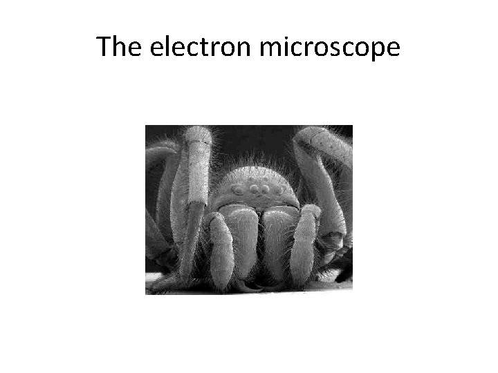 The electron microscope 