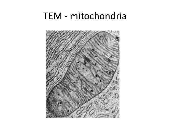 TEM - mitochondria 