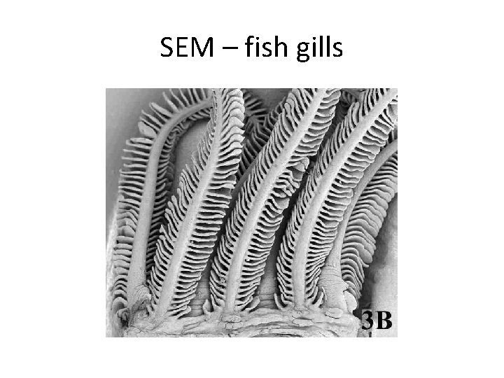 SEM – fish gills 