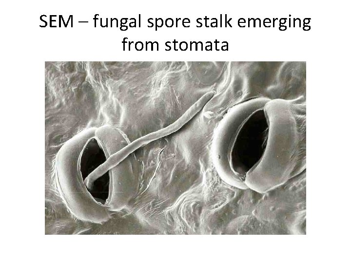 SEM – fungal spore stalk emerging from stomata 
