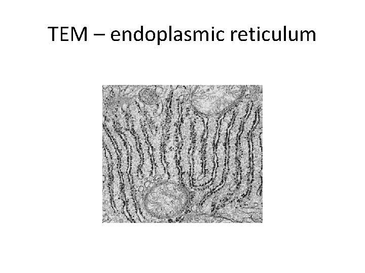TEM – endoplasmic reticulum 