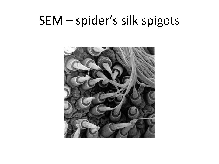 SEM – spider’s silk spigots 