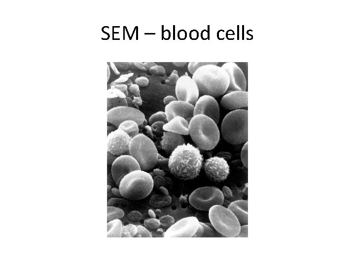 SEM – blood cells 