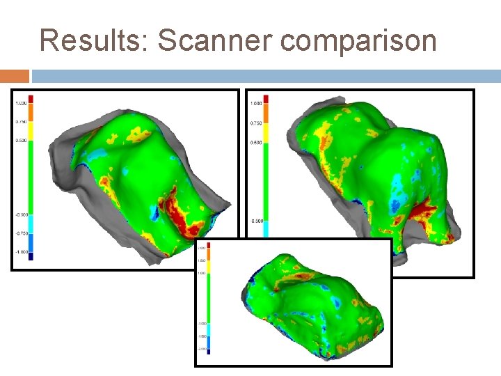 Results: Scanner comparison Results: Scanner comparison