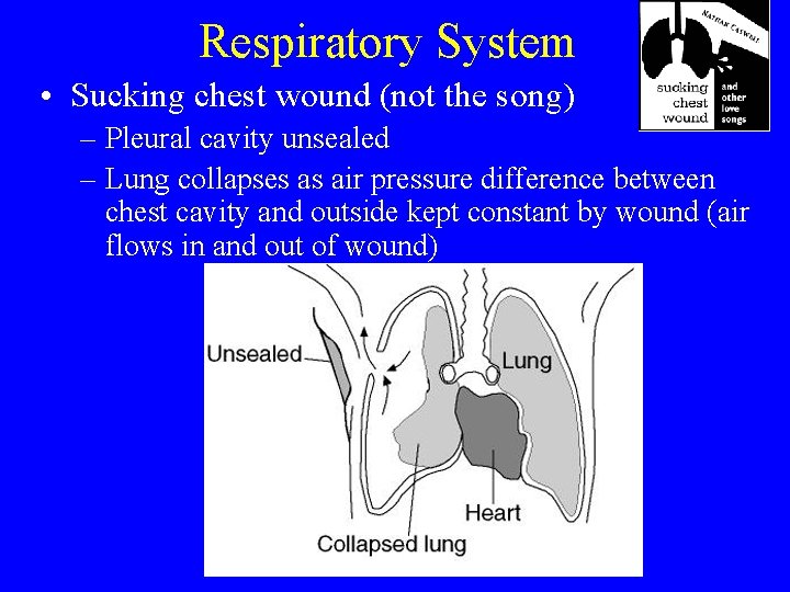 Respiratory System • Sucking chest wound (not the song) – Pleural cavity unsealed –