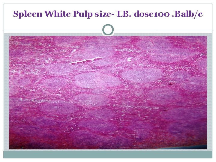 Spleen White Pulp size- LB. dose 100. Balb/c 