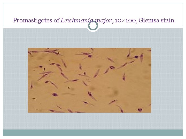 Promastigotes of Leishmania major, 10× 100, Giemsa stain. 