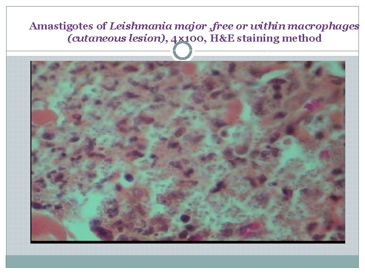 Amastigotes of Leishmania major , free or within macrophages (cutaneous lesion), 4× 100, H&E