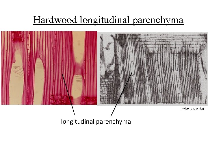Hardwood longitudinal parenchyma (Wilson and White) longitudinal parenchyma 