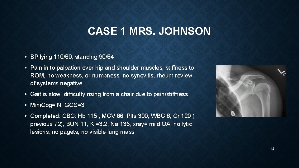 CASE 1 MRS. JOHNSON • BP lying 110/60, standing 90/64 • Pain in to