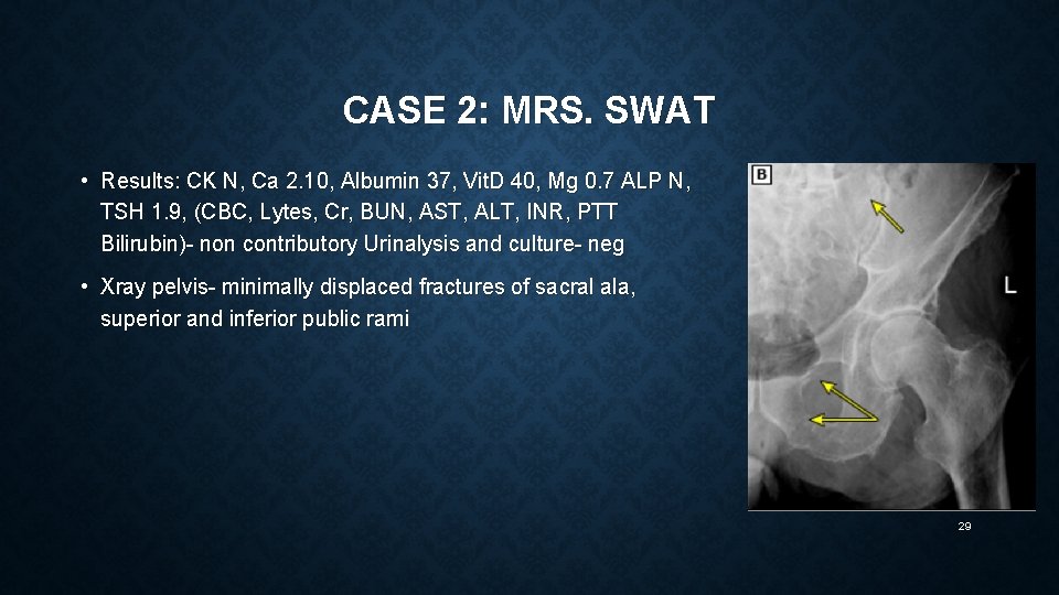 CASE 2: MRS. SWAT • Results: CK N, Ca 2. 10, Albumin 37, Vit.