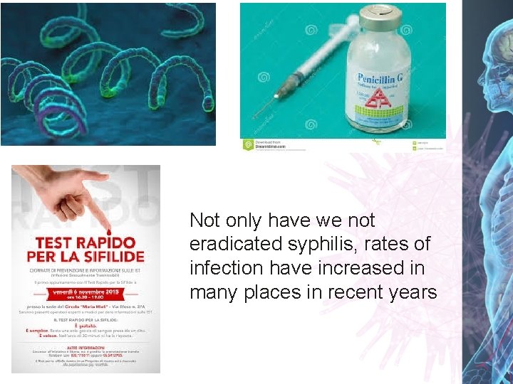 Not only have we not eradicated syphilis, rates of infection have increased in many