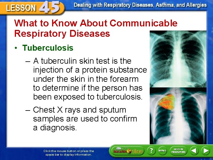 What to Know About Communicable Respiratory Diseases • Tuberculosis – A tuberculin skin test