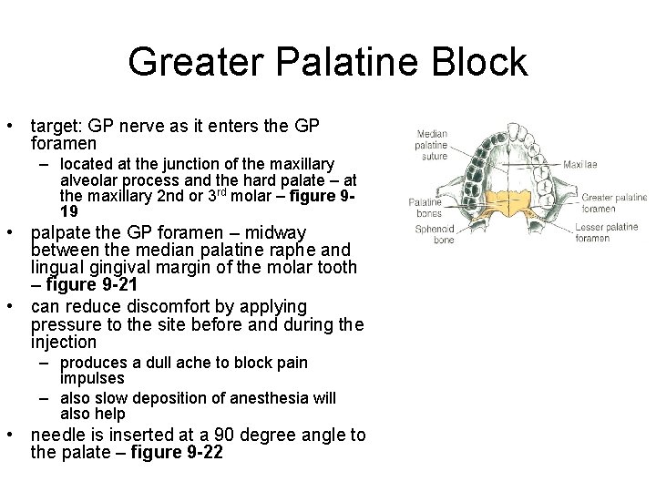 Greater Palatine Block • target: GP nerve as it enters the GP foramen –
