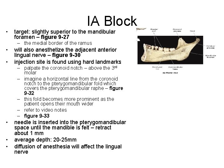  • IA Block target: slightly superior to the mandibular foramen – figure 9