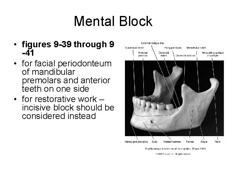 Mental Block • figures 9 -39 through 9 -41 • for facial periodonteum of