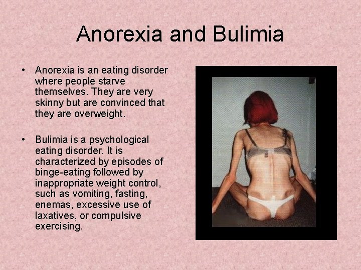 Anorexia and Bulimia • Anorexia is an eating disorder where people starve themselves. They