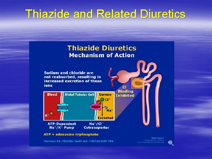 Thiazide and Related Diuretics 